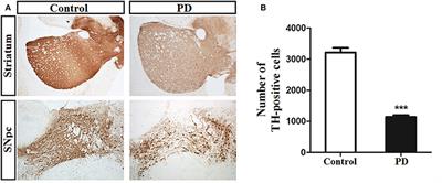 Metabolic Disturbances in the Striatum and Substantia Nigra in the Onset and Progression of <mark class="highlighted">MPTP-Induced Parkinsonism</mark> Model
